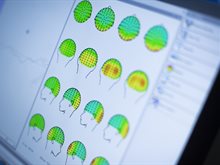 Analysing brain pattern at the Institute of Mental Health