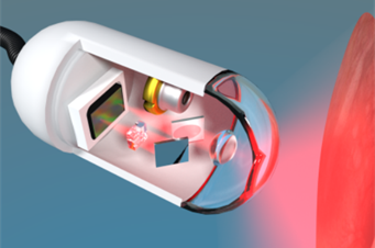 Low-cost miniaturised capsule endoscope to enable advanced imaging for screening and triage