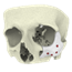 Supporting fractured bones during healing