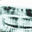Dr Adam Celiz awarded RSC prize for work on fillings that heal your teeth
