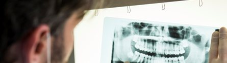 Fillings that heal your teeth