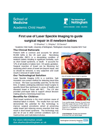 First use of Laser Speckle Imaging to guide surgical repair in ill newborn babies