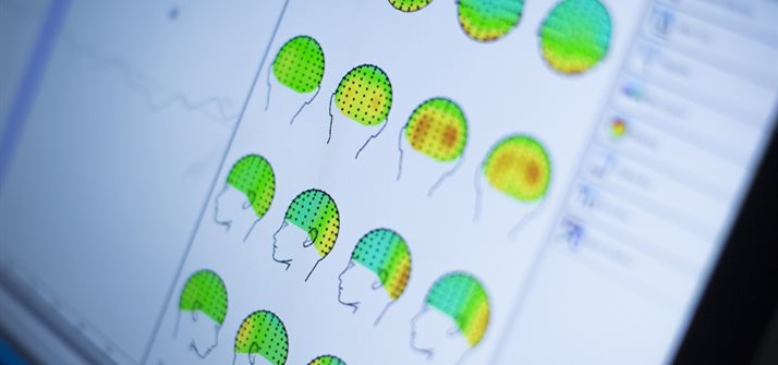 Analysing brain pattern at the Institute of Mental Health