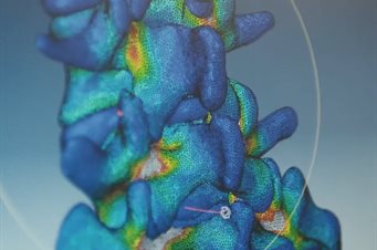Biomechanical modelling of the spine