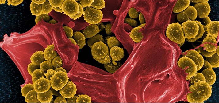 bacteria