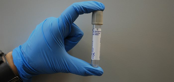 medical examination glove